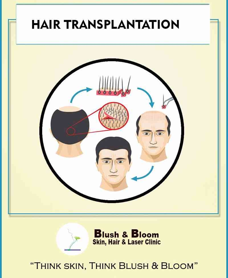 Liposuction 
Rhinoplasty 
Implants 
Tummytuck 
Gyn... main image