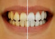 Want to transform your smile in this festive seaso... main image