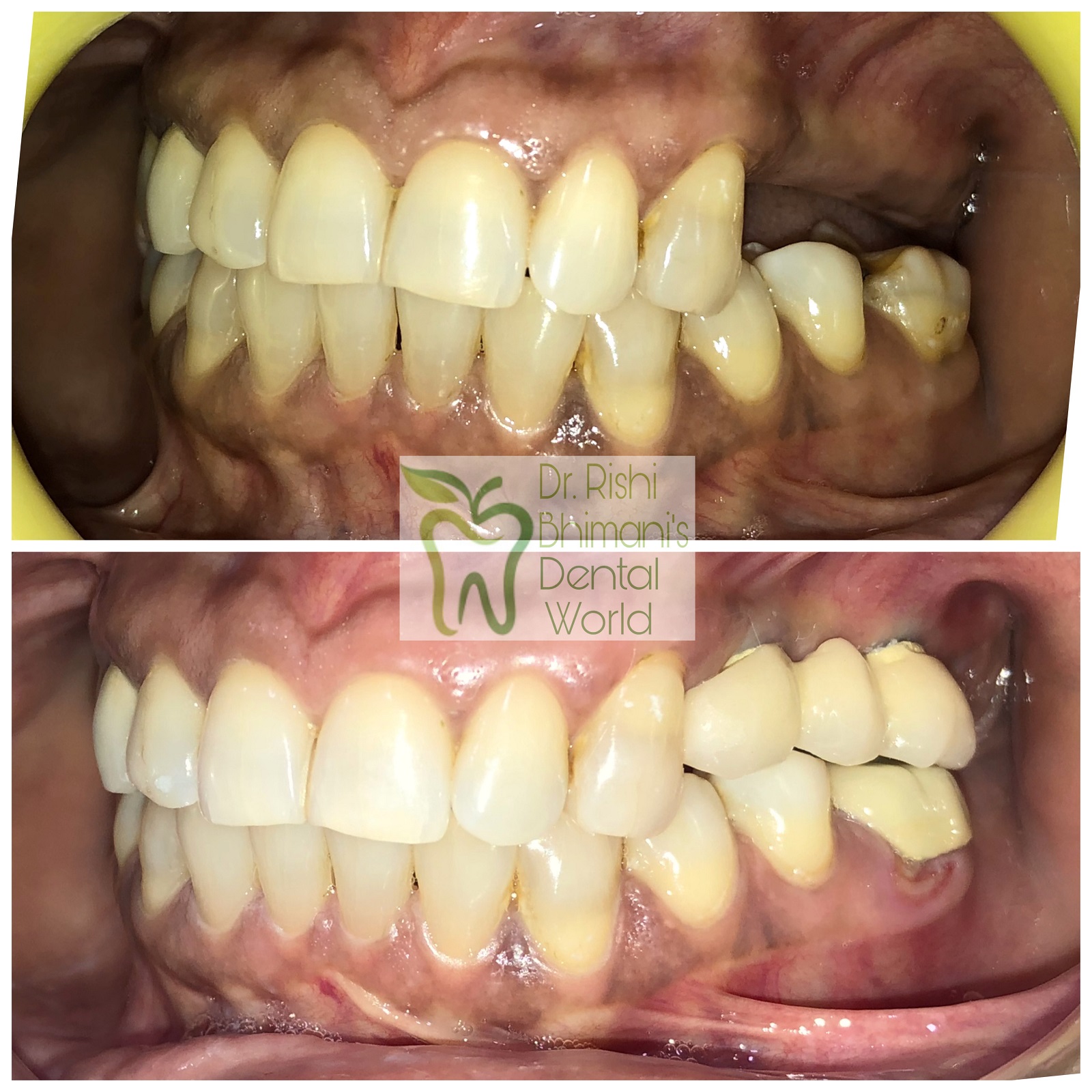 DENTAL IMPLANTS
Missing teeth can be replaced b... main image