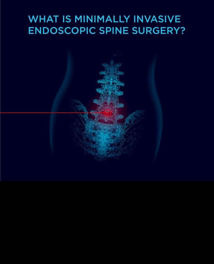 Walking on the same day after spine surgery is ... main image