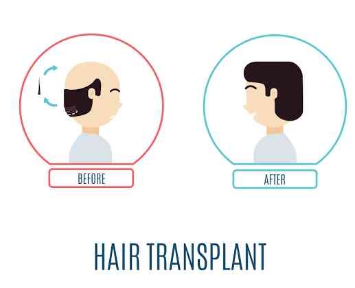 Liposuction 
Rhinoplasty 
Implants 
Tummytuck 
Gyn... main image