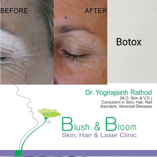 Liposuction 
Rhinoplasty 
Implants 
Tummytuck 
Gyn... main image