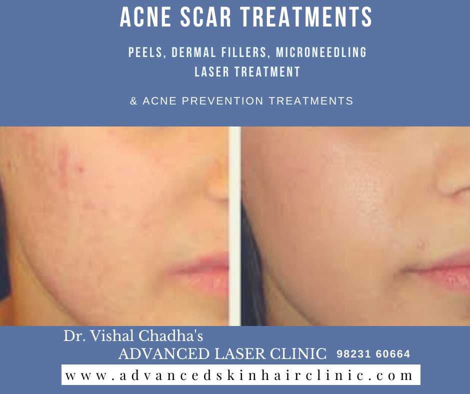 advanced skin care solutions