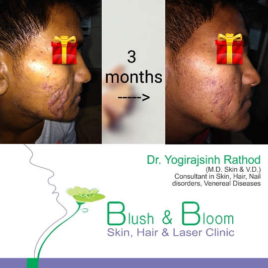 Think_Skin_Think_Blush_& _Bloom skin_specialist_in... main image