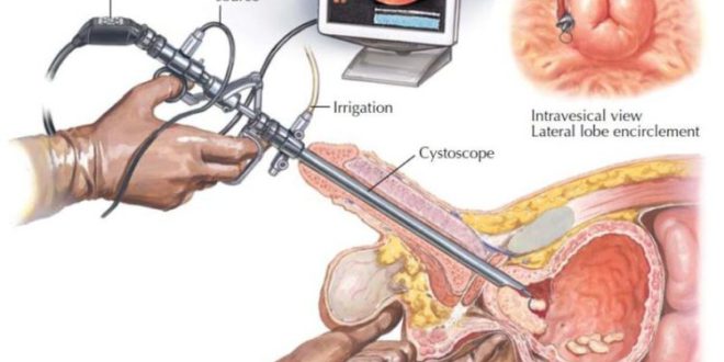 Best Doctor For Urology Problems Like Renal Calculi Prostate