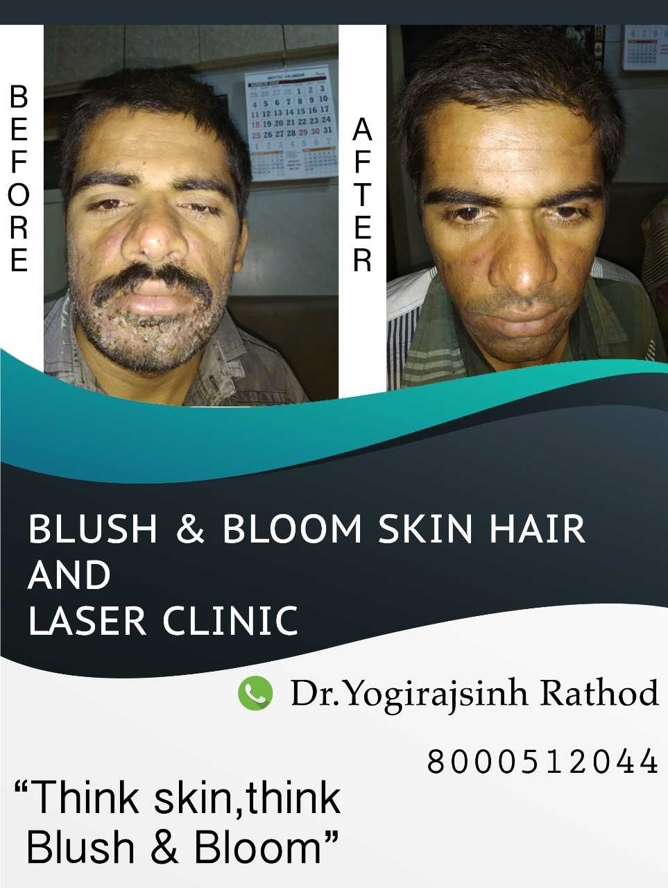Think_Skin_Think_Blush_& _Bloom skin_specialist_in... main image