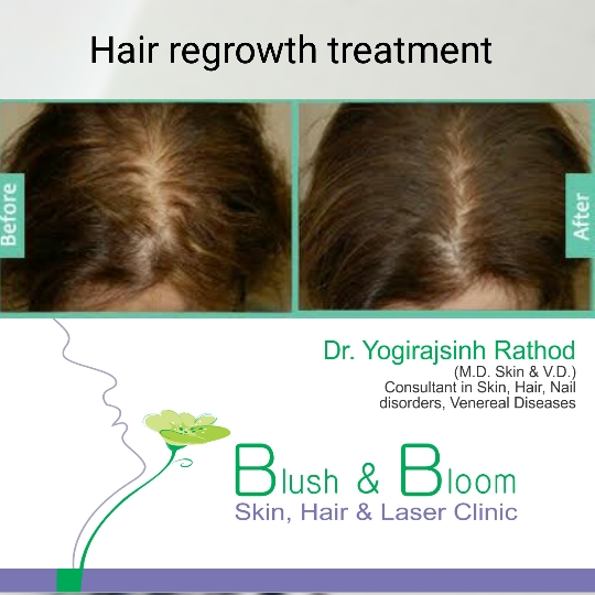 Think_Skin_Think_Blush_& _Bloom skin_specialist_in... main image