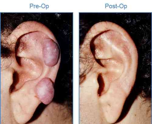 Liposuction 
Rhinoplasty 
Implants 
Tummytuck 
Gyn... main image