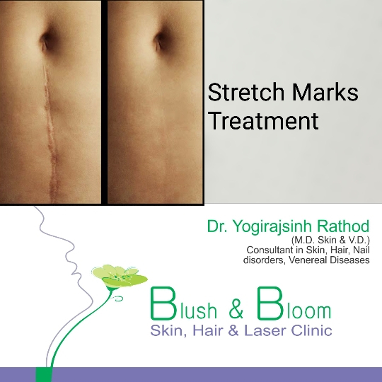 Think_Skin_Think_Blush_& _Bloom skin_specialist_in... main image