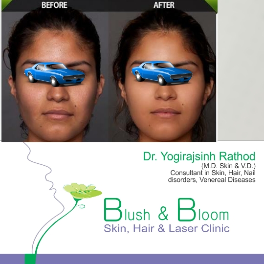 Think_Skin_Think_Blush_& _Bloom skin_specialist_in... main image