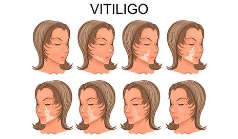 Liposuction 
Rhinoplasty 
Implants 
Tummytuck 
Gyn... main image