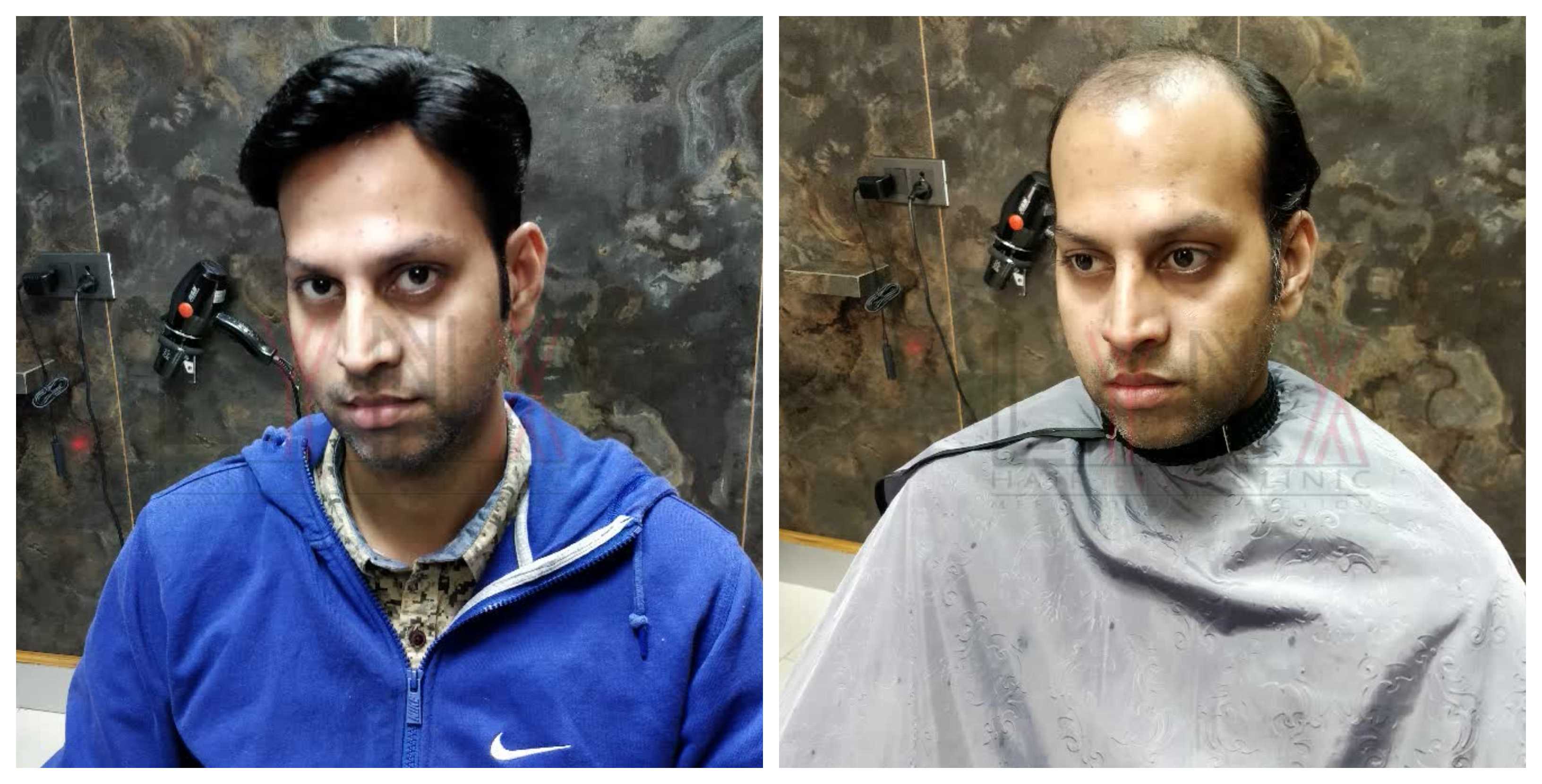 Hair Bonding In Gharoli Dairy Farm Delhi Gen Hair Wigs Weaving