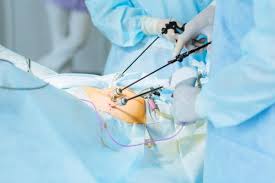 Laparoscopy is a surgical procedure that involv... main image