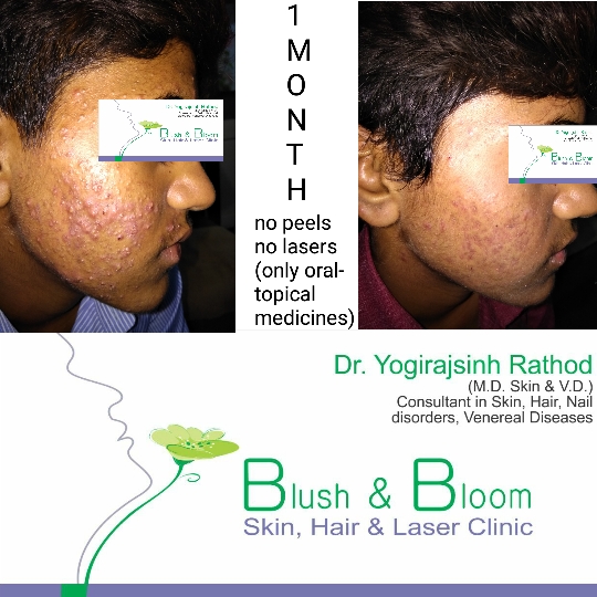 Think_Skin_Think_Blush_& _Bloom skin_specialist_in... main image
