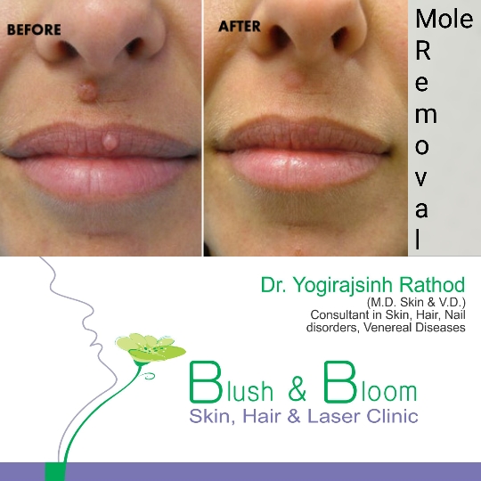 Think_Skin_Think_Blush_& _Bloom skin_specialist_in... main image