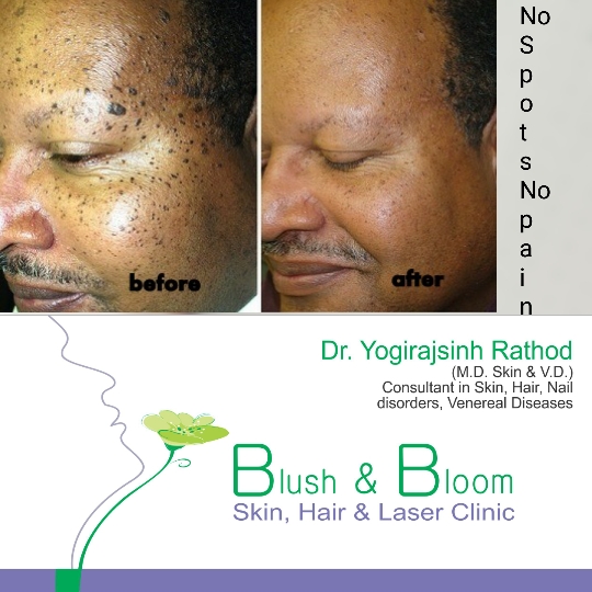 Think_Skin_Think_Blush_& _Bloom skin_specialist_in... main image