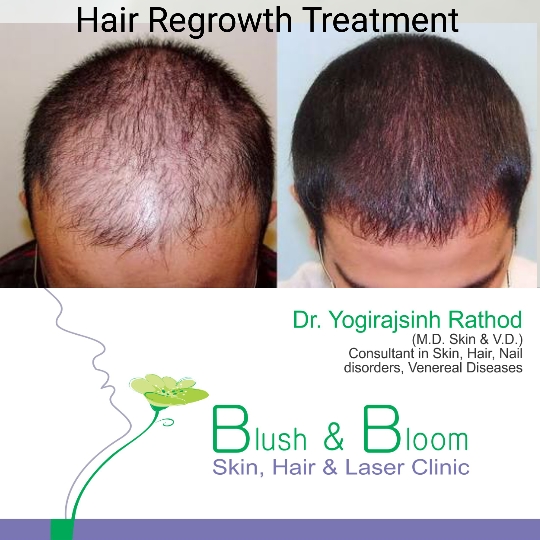 Think_Skin_Think_Blush_& _Bloom skin_specialist_in... main image