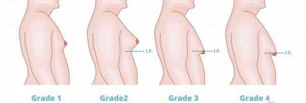 Liposuction 
Rhinoplasty 
Implants 
Tummytuck 
Gyn... main image