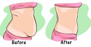 Liposuction 
Rhinoplasty 
Implants 
Tummytuck 
Gyn... main image