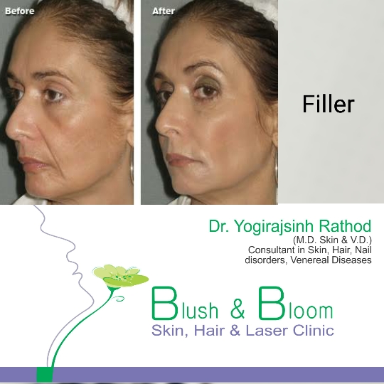 Liposuction 
Rhinoplasty 
Implants 
Tummytuck 
Gyn... main image