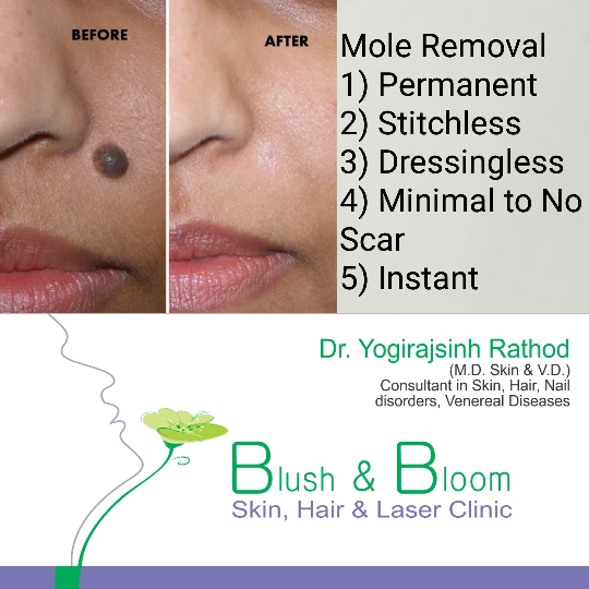 Think_Skin_Think_Blush_& _Bloom skin_specialist_in... main image