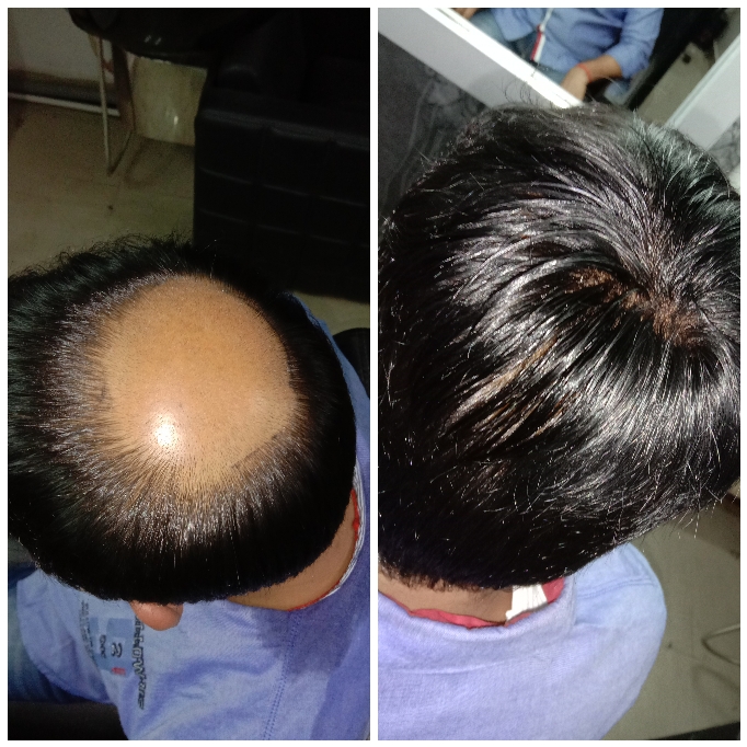 Image Blog