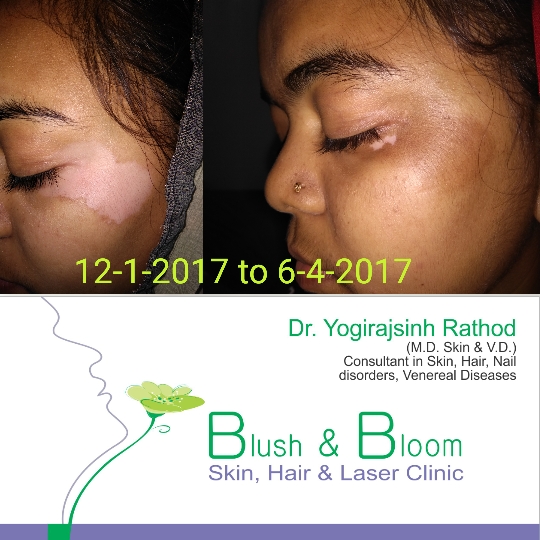 Think_Skin_Think_Blush_& _Bloom skin_specialist_in... main image