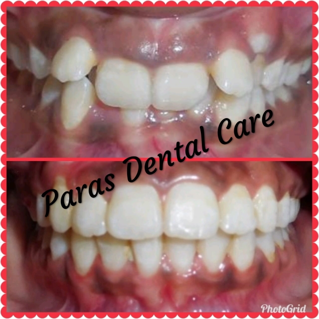 Whatever the cause of your crooked or irregular... main image