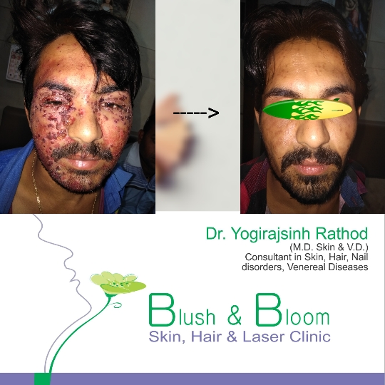 Think_Skin_Think_Blush_& _Bloom skin_specialist_in... main image