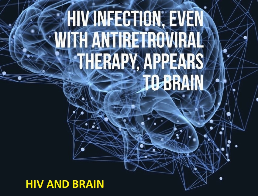 MANY PATIENTS WHO ARE IN LATE STAGES OF HIV DEV... main image