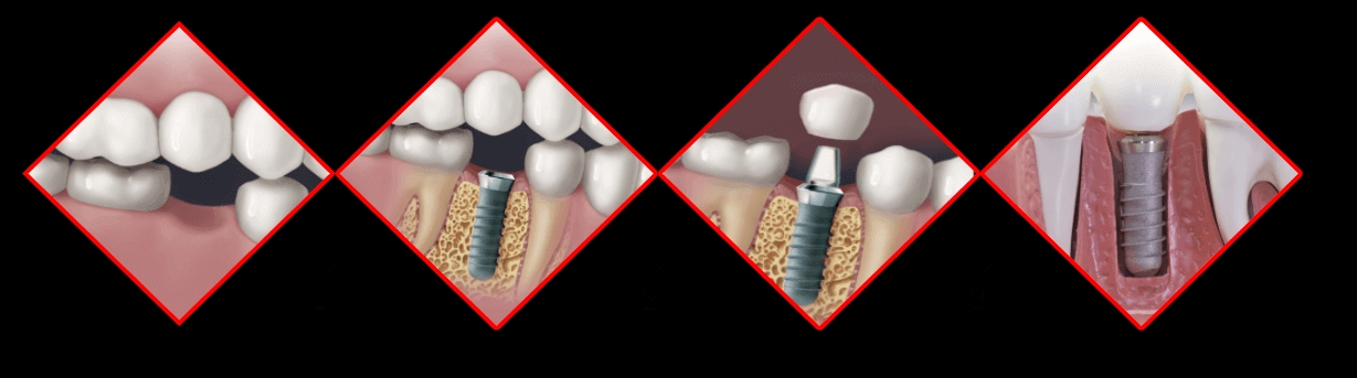 Our dedicated team of dentist help you to maint... main image