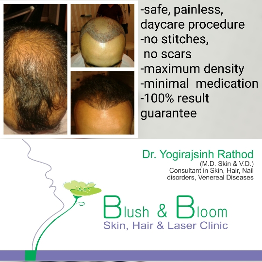 Liposuction 
Rhinoplasty 
Implants 
Tummytuck 
Gyn... main image