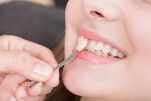 Ways to Re-create smile without Braces

When peopl... main image