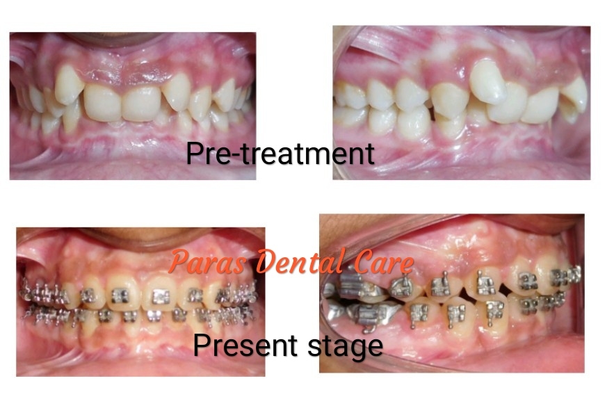 Patient came with the complaints of irregular u... main image