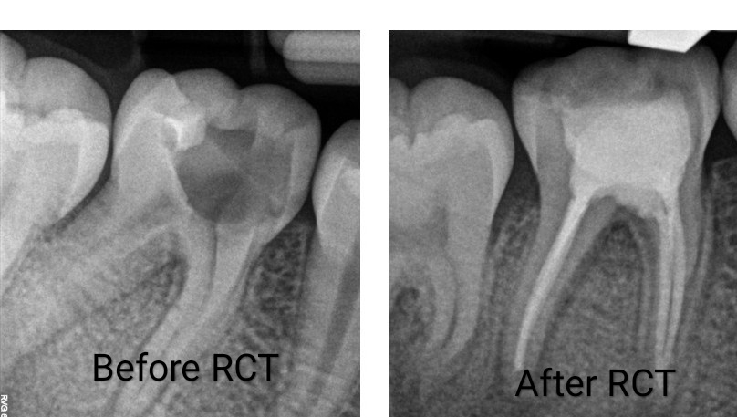 With modern dental equipments and advanced tech... main image