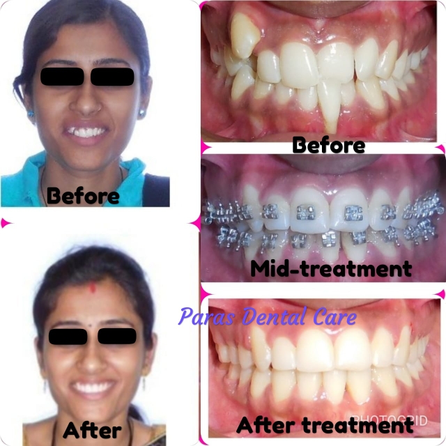 Patient came to our dental clinic with a complaint... main image