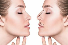 Liposuction 
Rhinoplasty 
Implants 
Tummytuck 
Gyn... main image