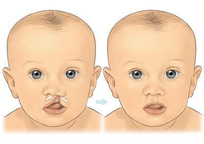 Liposuction 
Rhinoplasty 
Implants 
Tummytuck 
Gyn... main image