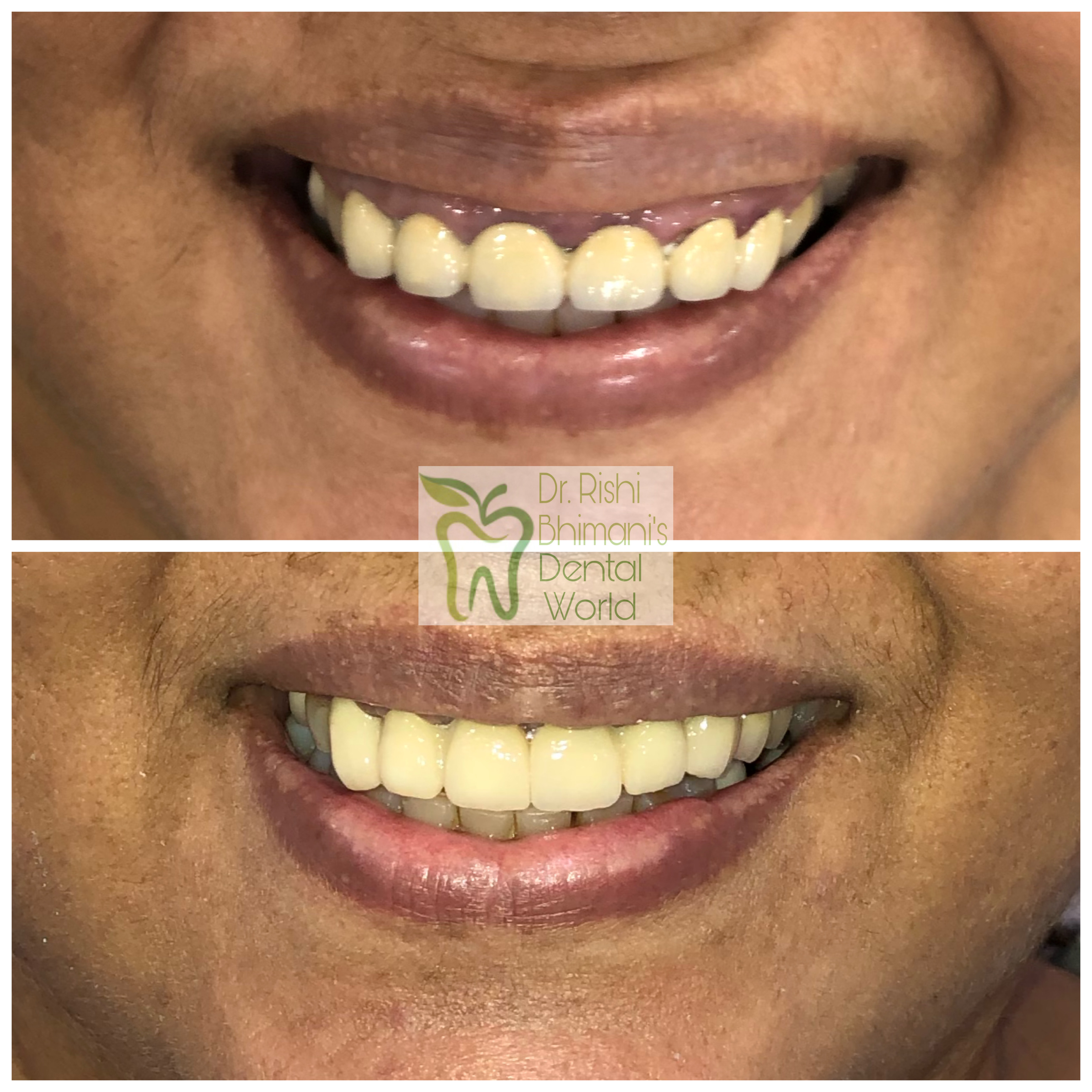 SMILE DESIGNING 
SMILE DESIGNING is a dental tr... main image