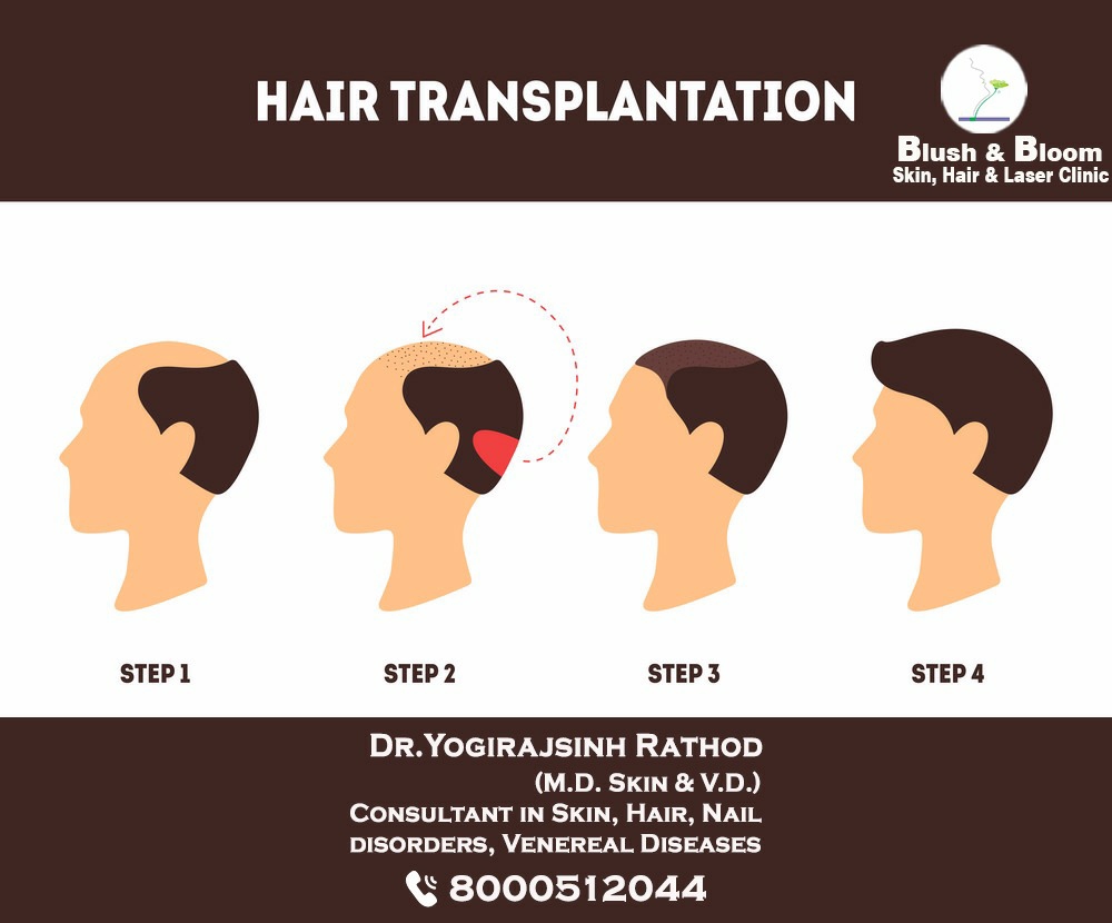 Liposuction 
Rhinoplasty 
Implants 
Tummytuck 
Gyn... main image