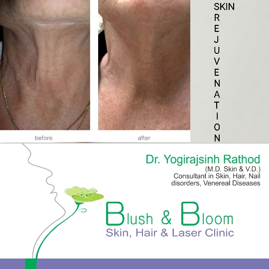 Liposuction 
Rhinoplasty 
Implants 
Tummytuck 
Gyn... main image