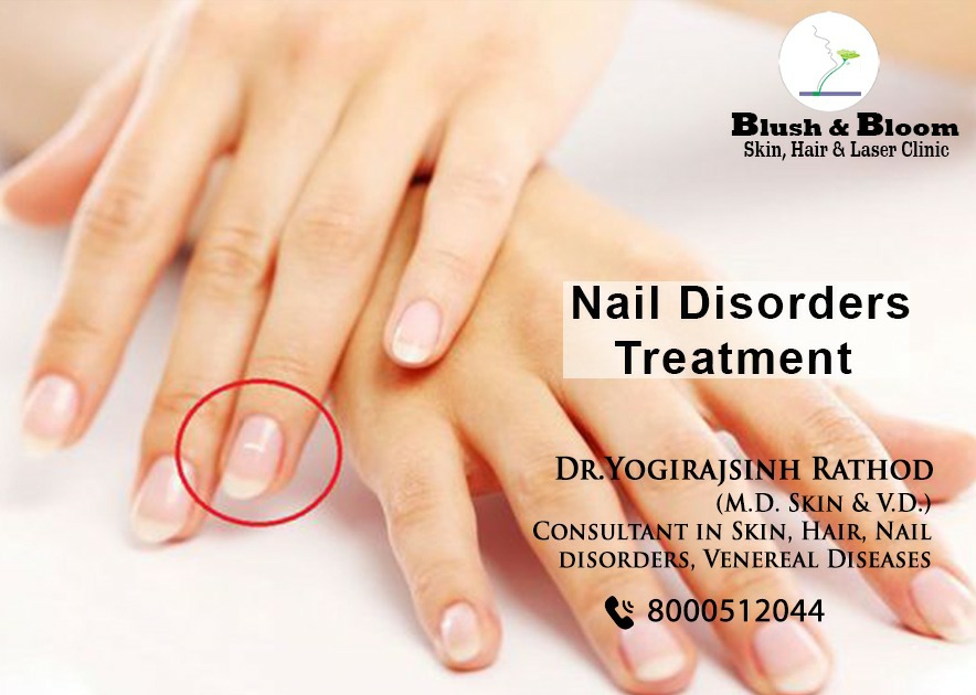 Think_Skin_Think_Blush_& _Bloom skin_specialist_in... main image