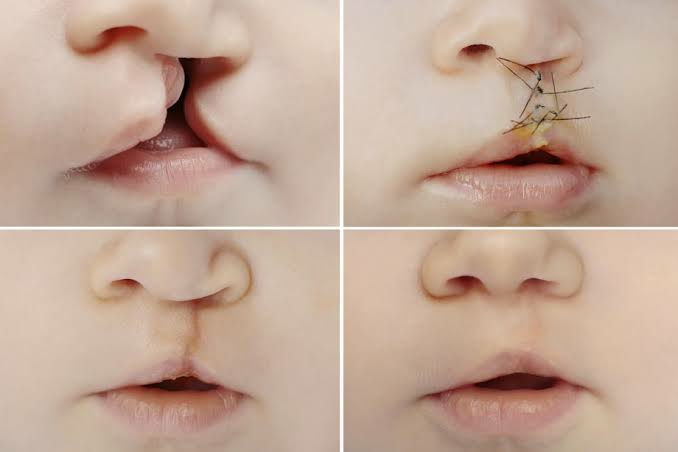 Liposuction 
Rhinoplasty 
Implants 
Tummytuck 
Gyn... main image