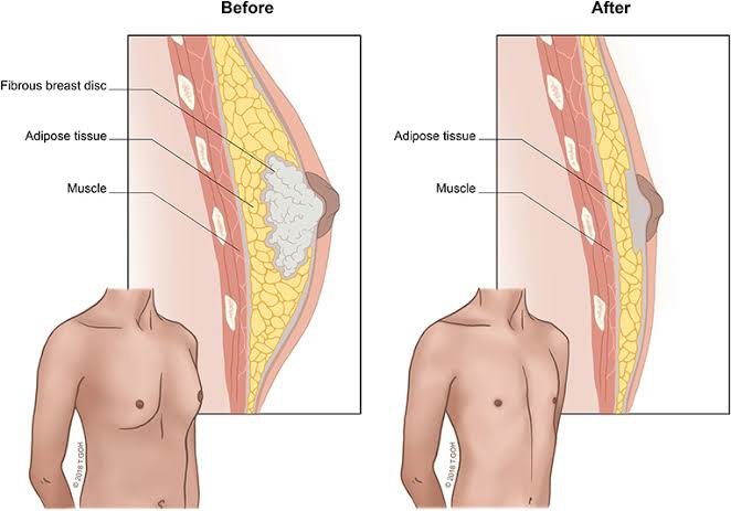 Liposuction 
Rhinoplasty 
Implants 
Tummytuck 
Gyn... main image