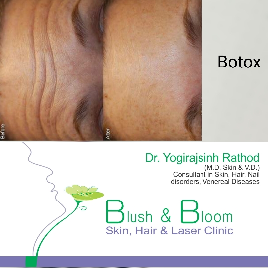 Liposuction 
Rhinoplasty 
Implants 
Tummytuck 
Gyn... main image