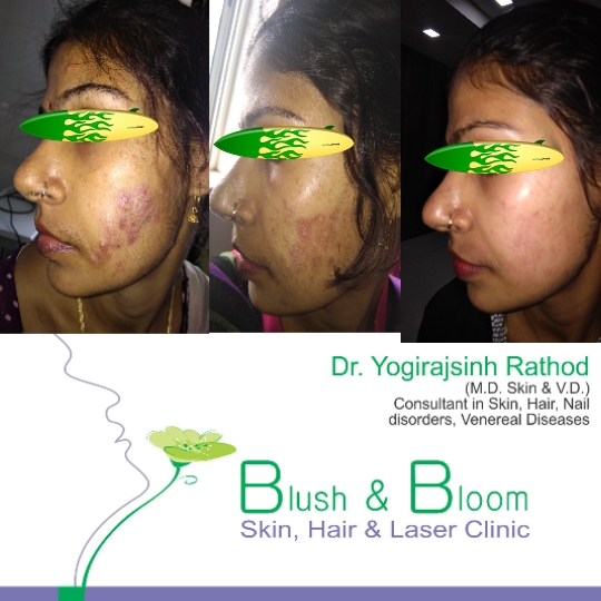 Think_Skin_Think_Blush_& _Bloom skin_specialist_in... main image