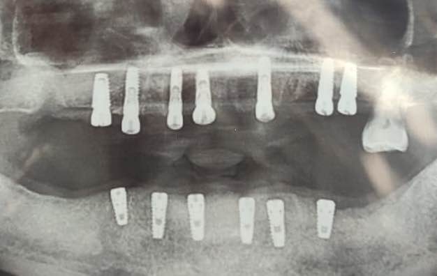 Visit Dr Pandit’s dental and implant center for re... main image