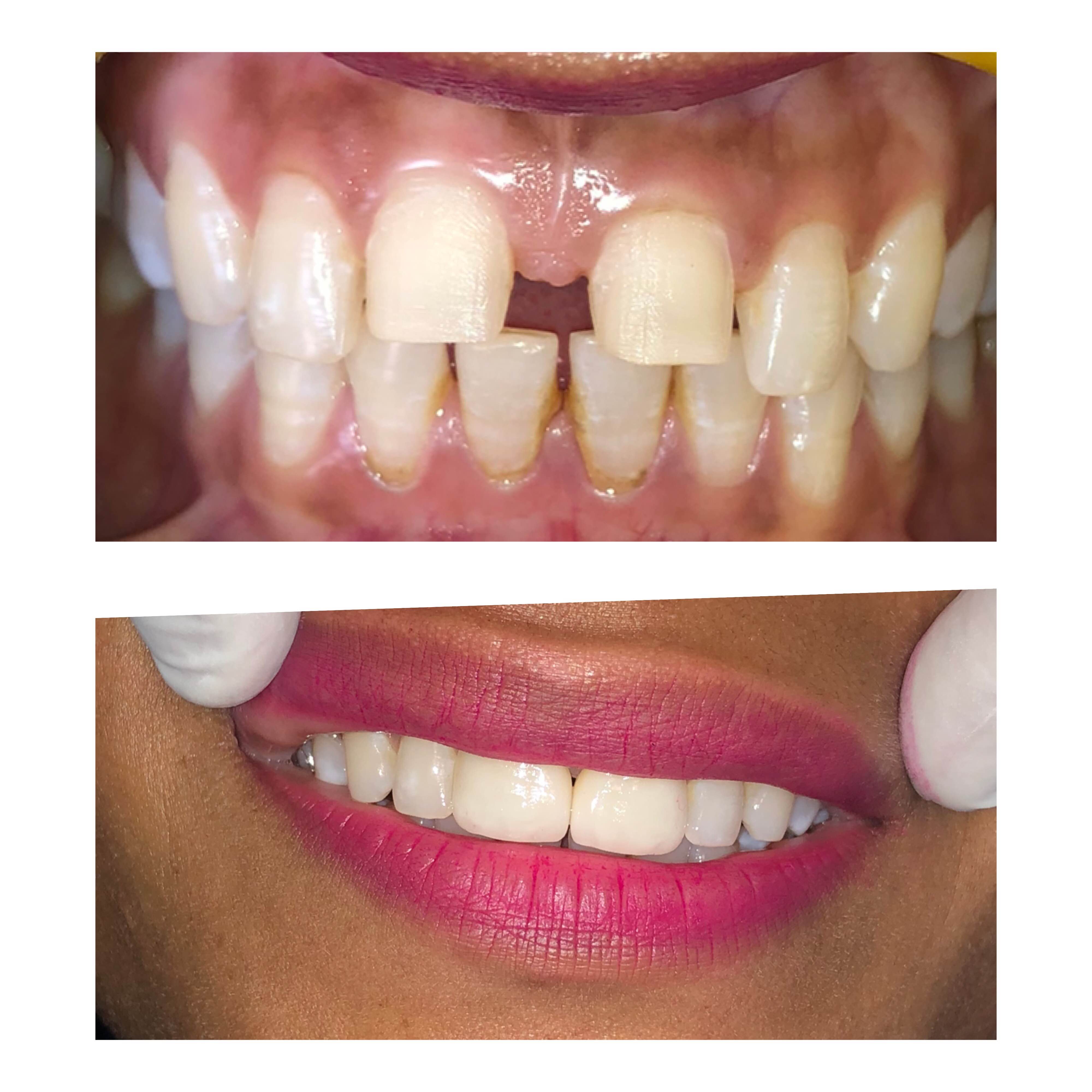 A healthy smile enhances the beauty of the face. C... main image
