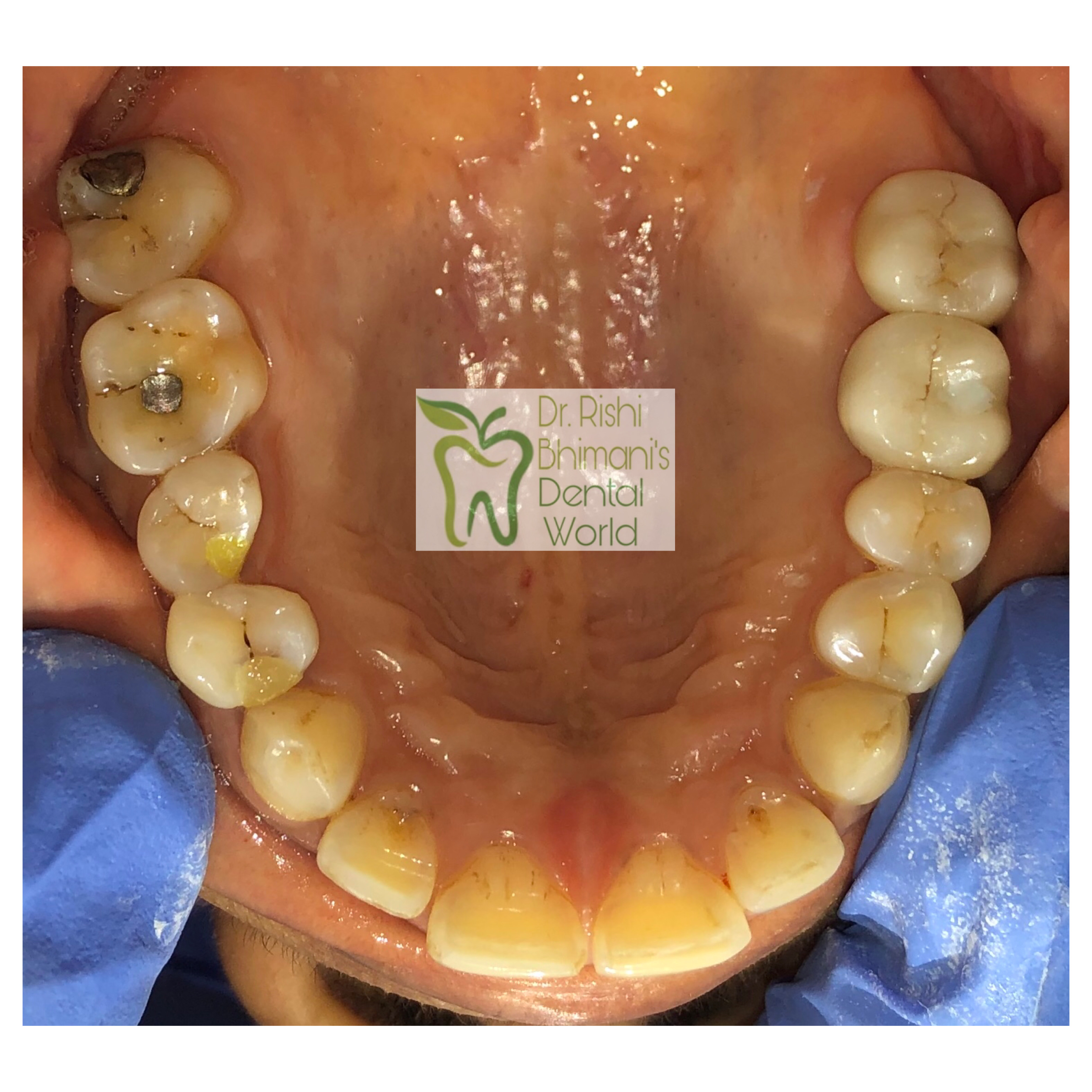 DENTAL IMPLANTS
DENTAL IMPLANTS can replace one... main image