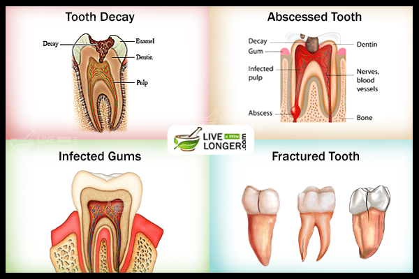 TOOTH PAIN may have a variety of causes- most c... main image